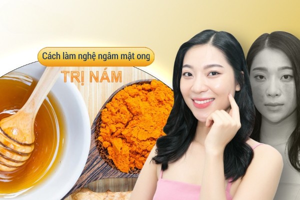 Hướng dẫn cách làm nghệ ngâm mật ong trị nám đơn giản tại nhà cho chị em