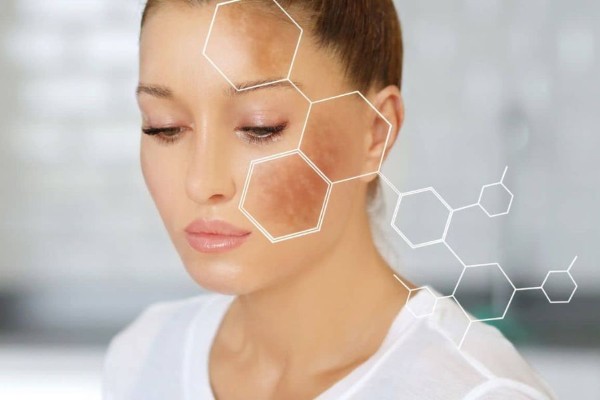 Cách làm nghệ ngâm mật ong trị nám có mang lại tác dụng như mong muốn?