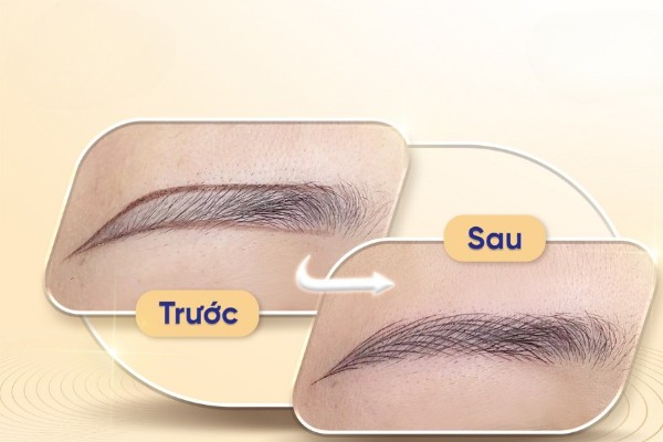 Hình ảnh trước và sau khi hẩm mỹ chân mày 