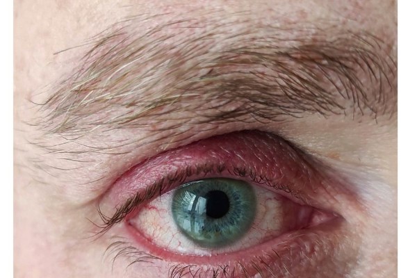 Người trong mắt chứa tia máu, lông mày chổi xể thường là dấu hiệu của “hung quang”