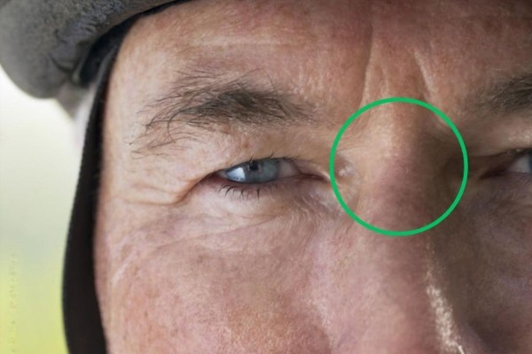 Sơn căn đen, lõm thường mang lại điềm báo không may mắn cho người sở hữu