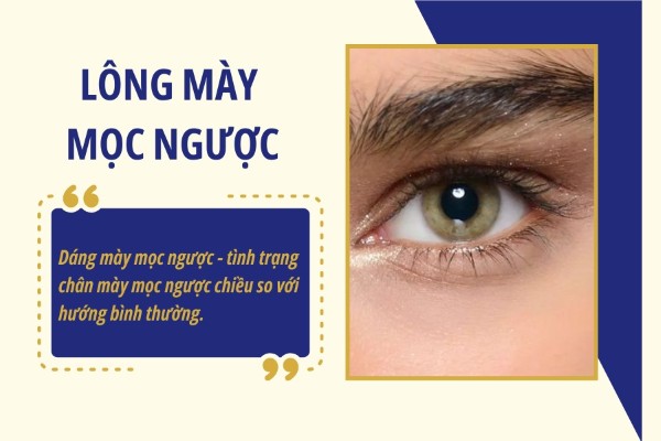 Lông mày dựng ngược là gì? Lông mày dựng ngược là gì?