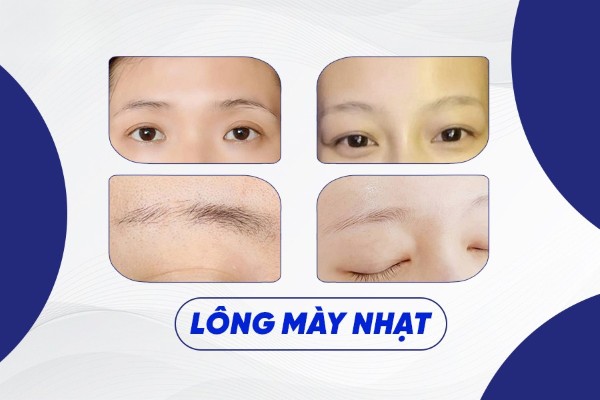 Nhìn tướng lông mày nhạt – Đoán chuẩn vận mệnh cuộc đời