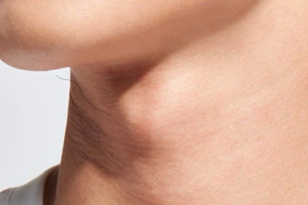 Là người cân bằng giữa lý trí và cảm xúc khi có vị trí lông tài mọc ở cổ Là người cân bằng giữa lý trí và cảm xúc khi có vị trí lông tài mọc ở cổ