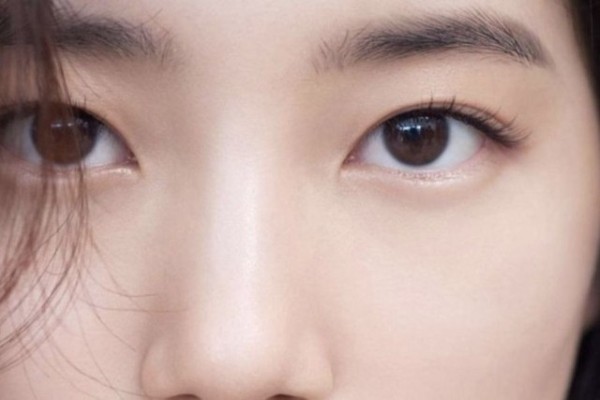 Nguyên nhân gây ra mắt 2 mí rưỡi