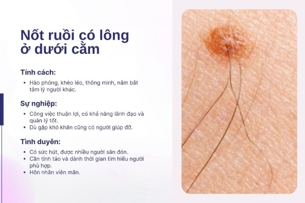 Nốt ruồi có lông ở cằm – Nốt ruồi may mắn của đàn ông Nốt ruồi có lông ở cằm – Nốt ruồi may mắn của đàn ông