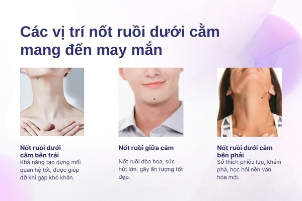 Các vị trí nốt ruồi dưới cằm mang đến may mắn Các vị trí nốt ruồi dưới cằm mang đến may mắn
