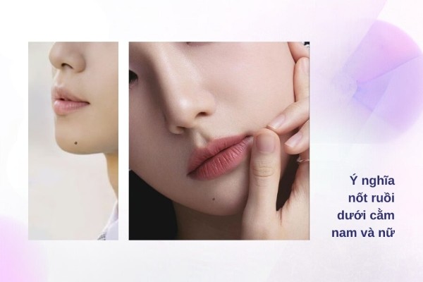 Nốt ruồi ở cằm có ý nghĩa gì đối vời đàn ông và phụ nữ Nốt ruồi ở cằm có ý nghĩa gì đối vời đàn ông và phụ nữ