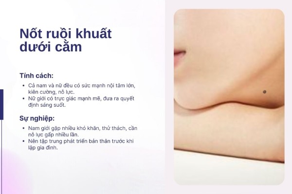Nốt ruồi khuất dưới cằm – Nữ có trực giác mạnh, nam kiên cường vượt khó Nốt ruồi khuất dưới cằm – Nữ có trực giác mạnh, nam kiên cường vượt khó