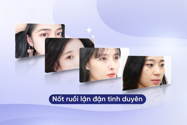 Top 10 nốt ruồi lận đận tình duyên nên xóa ngay để hạnh phúc Top 10 nốt ruồi lận đận tình duyên nên xóa ngay để hạnh phúc