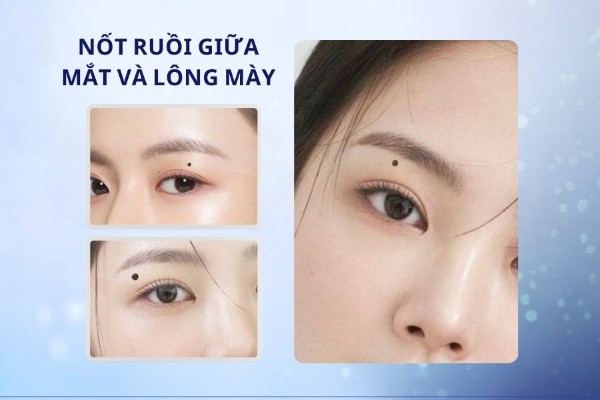 Nốt ruồi giữa mắt và lông mày – Trải qua hai, ba lần đò Nốt ruồi giữa mắt và lông mày – Trải qua hai, ba lần đò