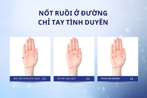 Nốt ruồi ở đường chỉ tay tình duyên – Khó tìm bạn tri kỷ trăm năm Nốt ruồi ở đường chỉ tay tình duyên – Khó tìm bạn tri kỷ trăm năm