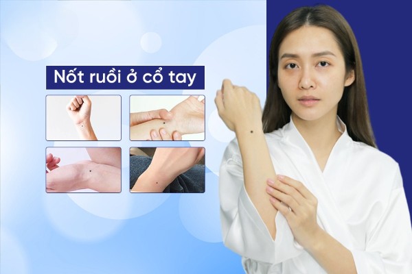 Giải mã bí ẩn nốt ruồi ở cổ tay – Tương lai lên đời hay lụn bại?
