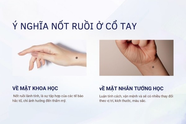 Nốt ruồi ngay cổ tay nam và nữ có ý nghĩa gì?