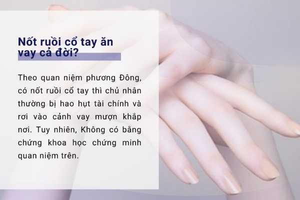 Giải đáp ý nghĩa câu nói: “Nốt ruồi cổ tay ăn vay cả đời”