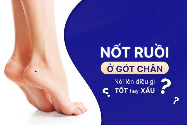 Ý nghĩa nốt ruồi ở gót chân: Cuộc đời giàu sang hay nghèo khổ