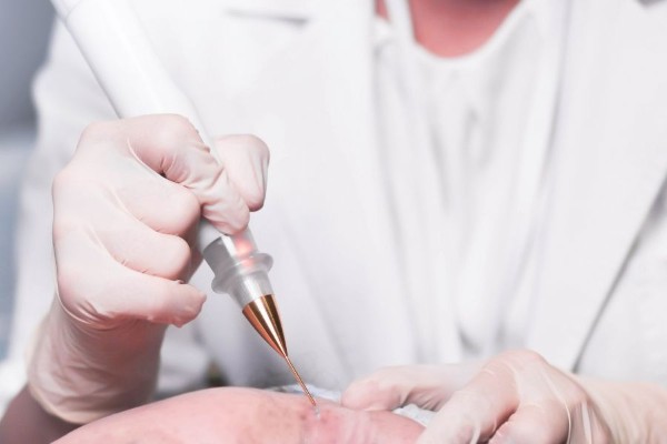 Việc có nên xóa nốt ruồi ở gót chân hay không hoàn toàn phụ thuộc vào nhu cầu của bạn