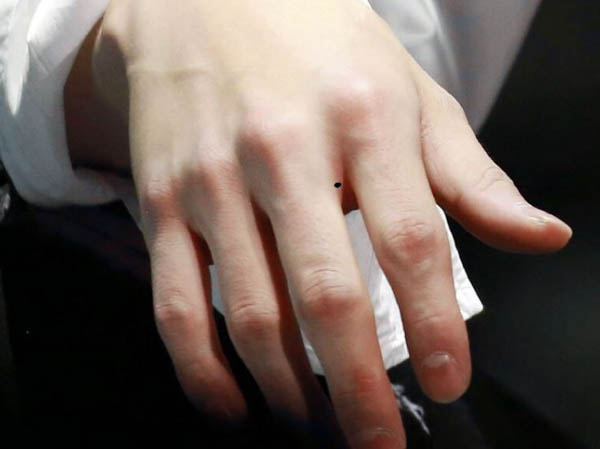 Nốt ruồi ở kẽ ngón tay trỏ và ngón giữa Nốt ruồi ở kẽ ngón tay trỏ và ngón giữa