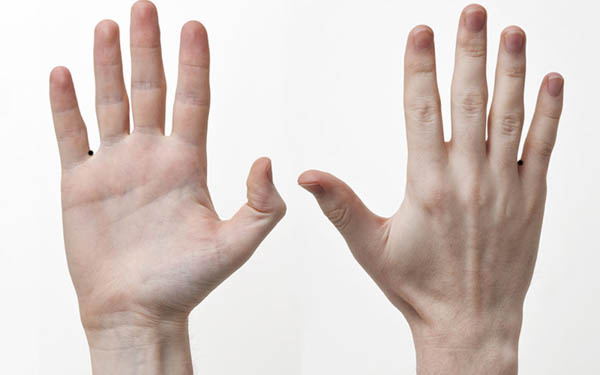 Nốt ruồi ở kẽ ngón tay áp út và ngón út Nốt ruồi ở kẽ ngón tay áp út và ngón út