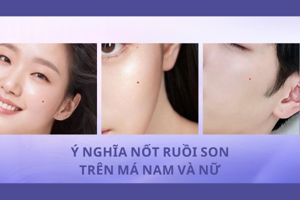 Ý nghĩa nốt ruồi son trên má nam và nữ