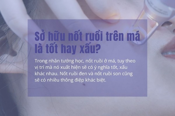 Sở hữu nốt ruồi trên má là tốt hay xấu?