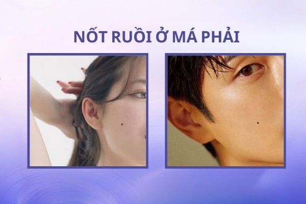 Nốt ruồi nằm ở má phải – Khởi đầu khó khăn, hậu vận sung túc