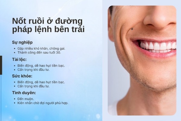 Nốt ruồi trên rãnh cười trái nữ và nam mang ý nghĩa gì?
