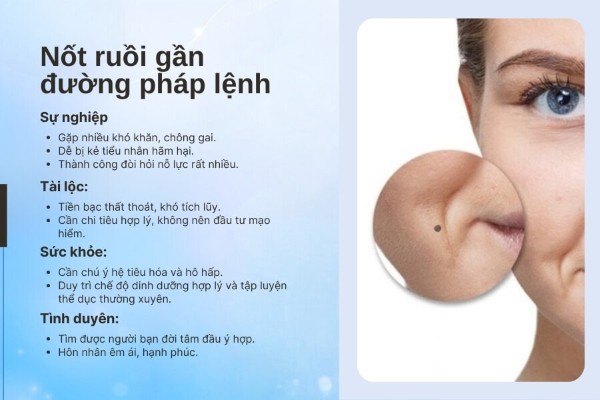 Nốt ruồi gần đường pháp lệnh – Cẩn trọng tiểu nhân hãm hại