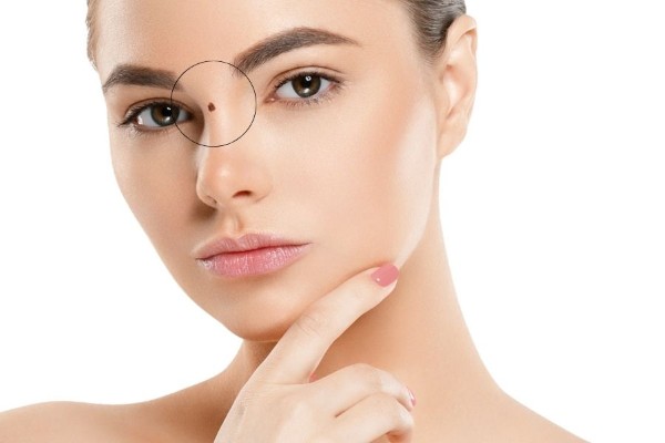 Sơn căn là vị trí nằm dưới ấn đường, nằm giữa hai mắt, và là vị trí cao nhất của sống mũi