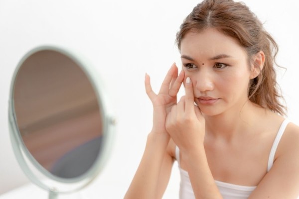 Không nên tự xóa nốt ruồi tại nhà để đảm bảo an toàn cho da