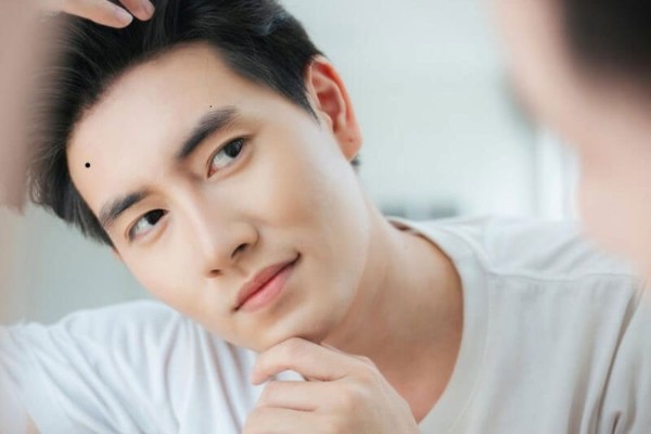 Nốt ruồi gần thái dương nam giới – Tướng người được quý nhân nâng đỡ