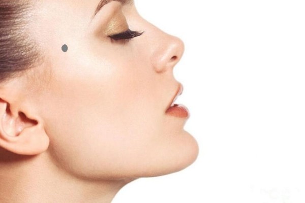 Nốt ruồi ở trán gần thái dương nữ – Thông minh, khéo léo