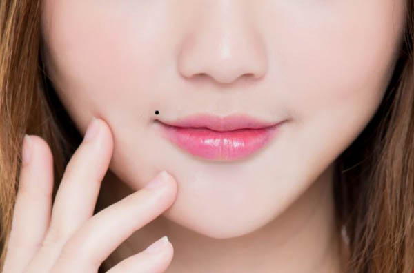 Nốt ruồi sát phu ở môi