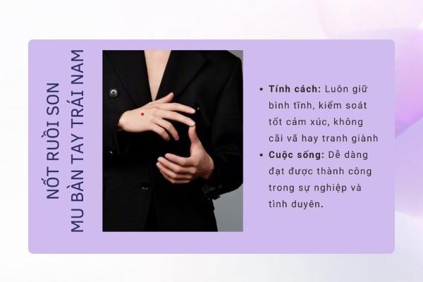 Nốt ruồi son trên mu bàn tay trái nam – May mắn từ khi sinh ra Nốt ruồi son trên mu bàn tay trái nam – May mắn từ khi sinh ra