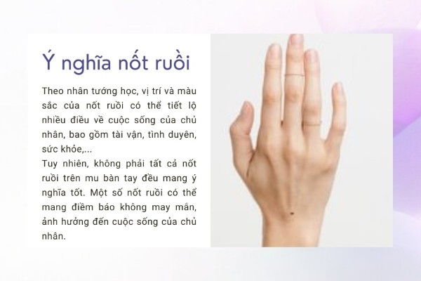 Có nốt ruồi trên mu bàn tay là tốt hay xấu? Có nốt ruồi trên mu bàn tay là tốt hay xấu?