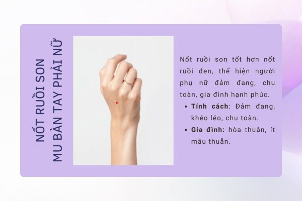 Ý nghĩa nốt ruồi son trên mu bàn tay phải nữ trong nhân tướng học Ý nghĩa nốt ruồi son trên mu bàn tay phải nữ trong nhân tướng học