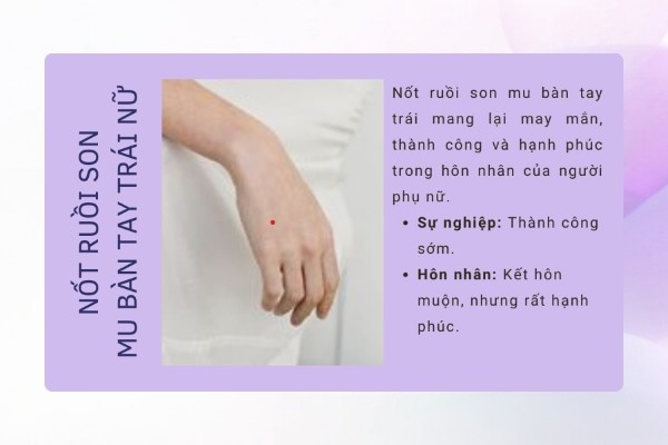Nốt ruồi son ở mu bàn tay trái nữ – Vận mệnh tốt đẹp Nốt ruồi son ở mu bàn tay trái nữ – Vận mệnh tốt đẹp