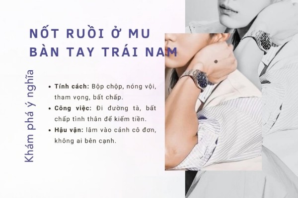 Xem ý nghĩa nốt ruồi trên mu bàn tay trái nam trong nhân tướng học Xem ý nghĩa nốt ruồi trên mu bàn tay trái nam trong nhân tướng học