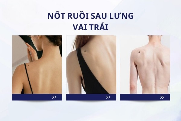 Nốt ruồi ở sau lưng vai trái – Cuộc sống có nhiều trắc trở