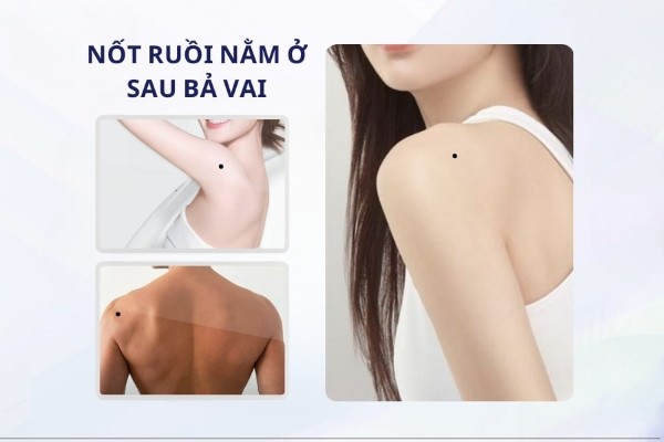 Nốt ruồi sau vai nam và nữ – Sống trong nhung lụa, không nặng gánh cơm áo, gạo tiền