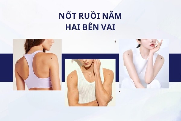 Nốt ruồi nằm trên 2 vai – Mọi sự đều thuận lợi, như ý