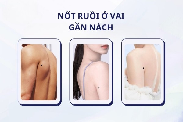 Nốt ruồi ở vai gần nách – Người lạc quan trong mọi hoàn cảnh