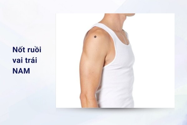 Nốt ruồi vai trái nam có ý nghĩa tốt hay xấu?