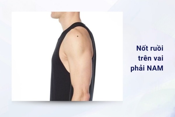 Nốt ruồi trên vai phải nam là nốt ruồi xấu, sự nghiệp và tình duyên đều không thuận lợi