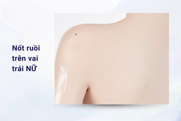 Nốt ruồi vai trái nữ mang ý nghĩa gì trong nhân tướng học?