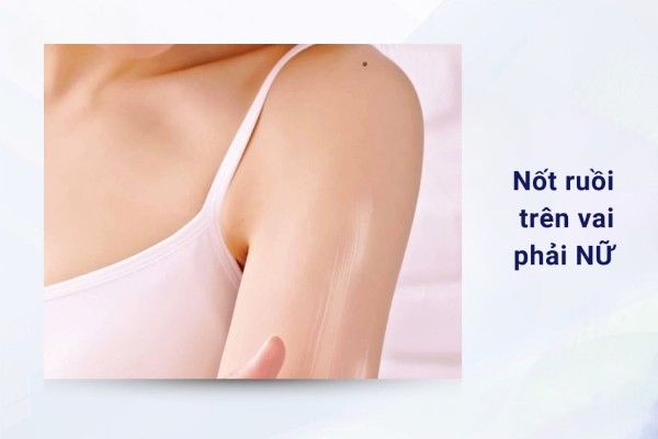 Ý nghĩa nốt ruồi ở bả vai phải nữ có khác với nam không?