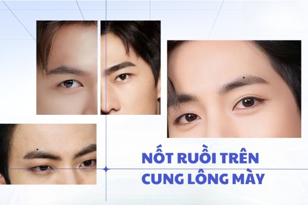 Nốt ruồi xấu trên mặt đàn ông nằm trêm cung lông mày