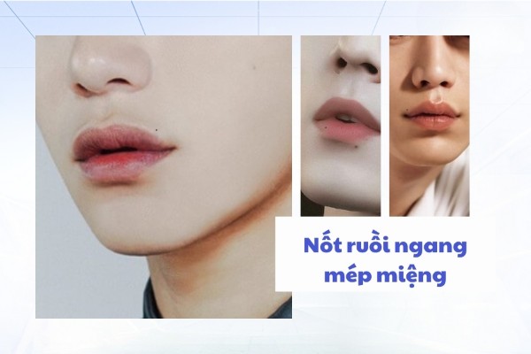 Nốt ruồi nằm ở vị trí ngang mép – Người ích kỷ, hẹp hòi