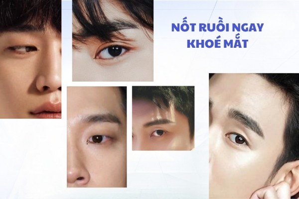 Nốt ruồi ở ngay dưới khóe mắt – Tướng phá tài