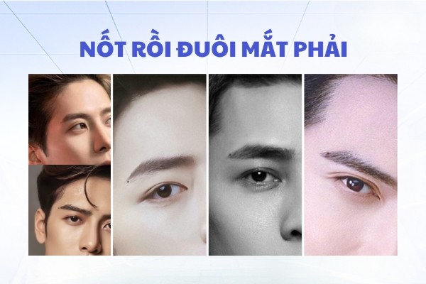 Nốt ruồi ở dưới đuôi mắt phải – Người không chung thủy
